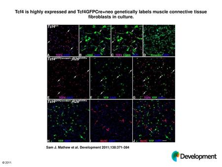 Tcf4 is highly expressed and Tcf4GFPCre+neo genetically labels muscle connective tissue fibroblasts in culture. Tcf4 is highly expressed and Tcf4GFPCre+neo.