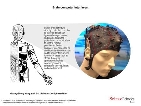 Brain-computer interfaces.