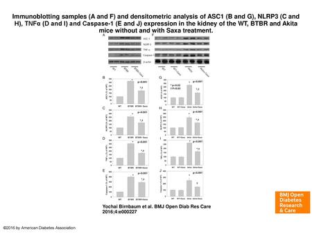 Immunoblotting samples (A and F) and densitometric analysis of ASC1 (B and G), NLRP3 (C and H), TNFα (D and I) and Caspase-1 (E and J) expression in the.