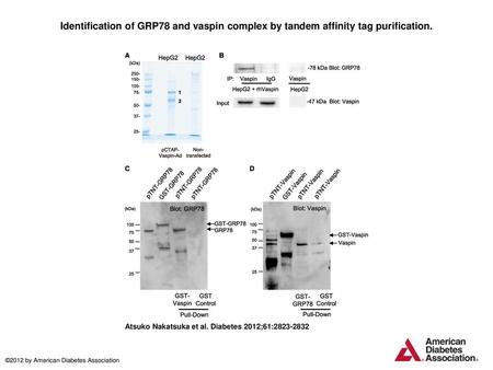 Identification of GRP78 and vaspin complex by tandem affinity tag purification. Identification of GRP78 and vaspin complex by tandem affinity tag purification.