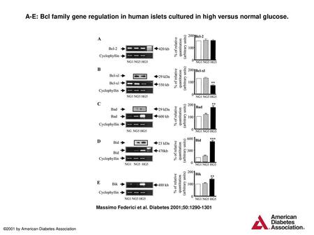 A-E: Bcl family gene regulation in human islets cultured in high versus normal glucose. A-E: Bcl family gene regulation in human islets cultured in high.