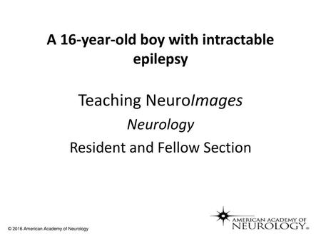 A 16-year-old boy with intractable epilepsy