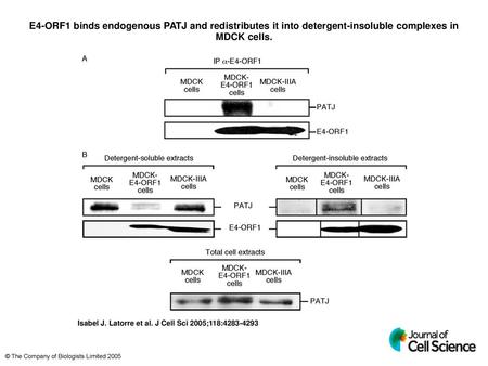 E4-ORF1 binds endogenous PATJ and redistributes it into detergent-insoluble complexes in MDCK cells. E4-ORF1 binds endogenous PATJ and redistributes it.