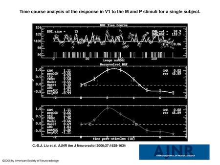 Time course analysis of the response in V1 to the M and P stimuli for a single subject. Time course analysis of the response in V1 to the M and P stimuli.